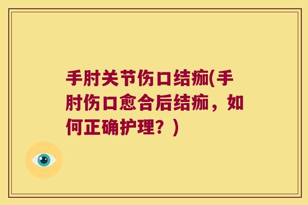 手肘关节伤口结痂(手肘伤口愈合后结痂,如何正确护理?) 手肘关节伤口结痂(手肘伤口愈合后结痂,如何正确护理?)