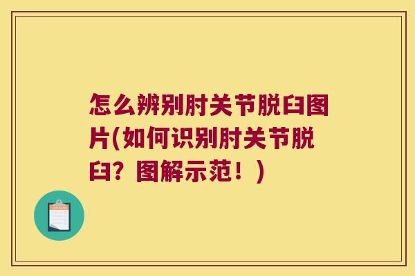 怎么辨别肘关节脱臼图片(如何识别肘关节脱臼?图解示范!) 怎么辨别肘关节脱臼图片(如何识别肘关节脱臼?图解示范!)