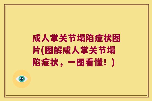 成人掌关节塌陷症状图片(图解成人掌关节塌陷症状,一图看懂!) 成人掌关节塌陷症状图片(图解成人掌关节塌陷症状,一图看懂!)
