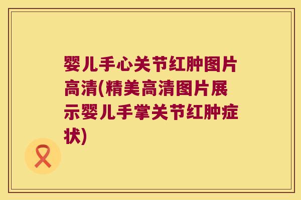 婴儿手心关节红肿图片高清(精美高清图片展示婴儿手掌关节红肿症状) 婴儿手心关节红肿图片高清(精美高清图片展示婴儿手掌关节红肿症状)