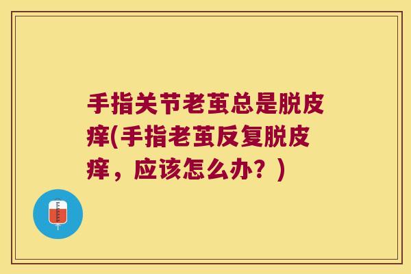 手指关节老茧总是脱皮痒(手指老茧反复脱皮痒，应该怎么办？)