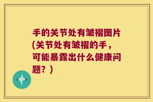 手的关节处有皱褶图片(关节处有皱褶的手，可能暴露出什么健康问题？)