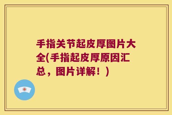 手指关节起皮厚图片大全(手指起皮厚原因汇总,图片详解!) 手指关节起皮厚图片大全(手指起皮厚原因汇总,图片详解!)
