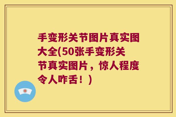 手变形关节图片真实图大全(50张手变形关节真实图片，惊人程度令人咋舌！)