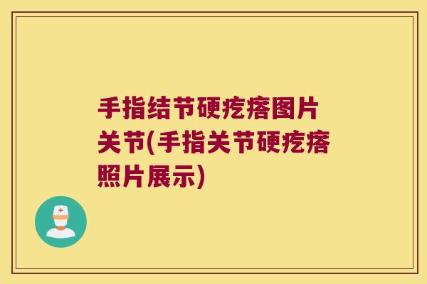 手指结节硬疙瘩图片 关节(手指关节硬疙瘩照片展示) 手指结节硬疙瘩图片 关节(手指关节硬疙瘩照片展示)
