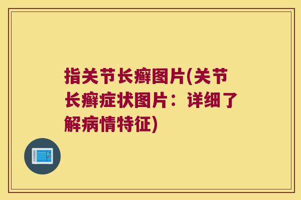 指关节长癣图片(关节长癣症状图片:详细了解情特征) 指关节长癣图片(关节长癣症状图片:详细了解情特征)