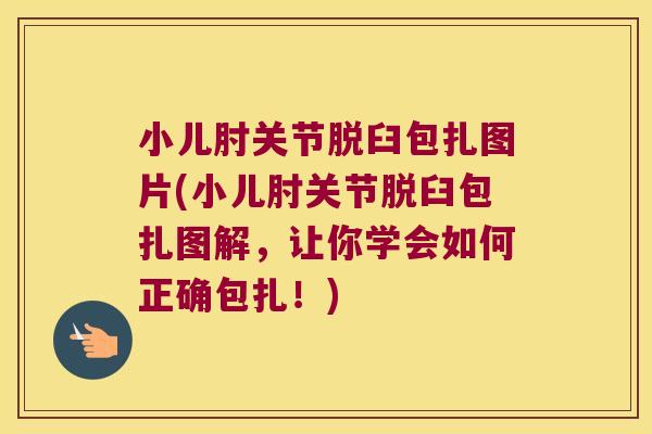 小儿肘关节脱臼包扎图片(小儿肘关节脱臼包扎图解,让你学会如何正确包扎!) 小儿肘关节脱臼包扎图片(小儿肘关节脱臼包扎图解,让你学会如何正确包扎!)