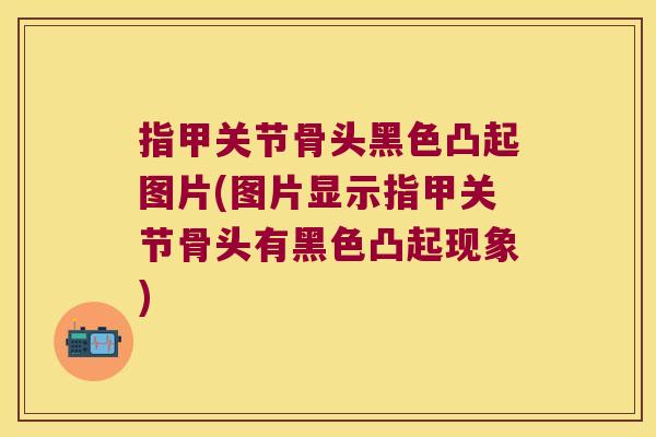 指甲关节骨头黑色凸起图片(图片显示指甲关节骨头有黑色凸起现象) 指甲关节骨头黑色凸起图片(图片显示指甲关节骨头有黑色凸起现象)