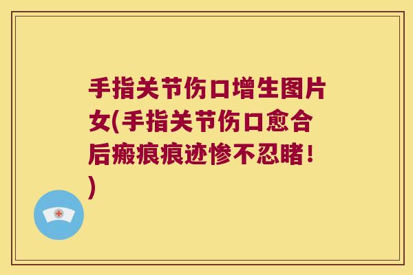 手指关节伤口增生图片女(手指关节伤口愈合后瘢痕痕迹惨不忍睹！)