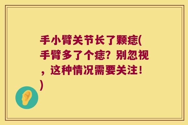 手小臂关节长了颗痣(手臂多了个痣？别忽视，这种情况需要关注！)