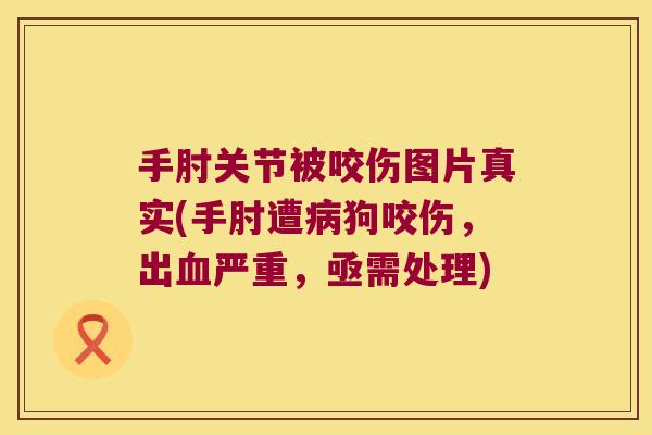 手肘关节被咬伤图片真实(手肘遭狗咬伤,出严重,亟需处理) 手肘关节被咬伤图片真实(手肘遭狗咬伤,出严重,亟需处理)