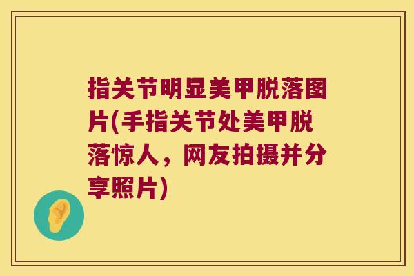 指关节明显美甲脱落图片(手指关节处美甲脱落惊人,网友拍摄并分享照片) 指关节明显美甲脱落图片(手指关节处美甲脱落惊人,网友拍摄并分享照片)