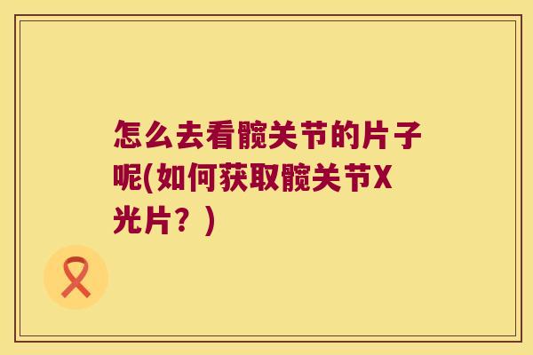 怎么去看髋关节的片子呢(如何获取髋关节X光片?) 怎么去看髋关节的片子呢(如何获取髋关节X光片?)