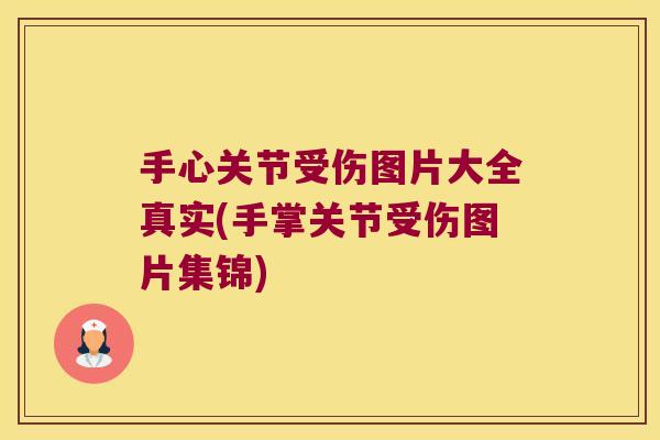 手心关节受伤图片大全真实(手掌关节受伤图片集锦) 手心关节受伤图片大全真实(手掌关节受伤图片集锦)
