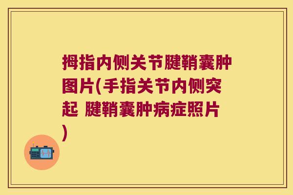 拇指内侧关节腱鞘囊肿图片(手指关节内侧突起 腱鞘囊肿症照片) 拇指内侧关节腱鞘囊肿图片(手指关节内侧突起 腱鞘囊肿症照片)