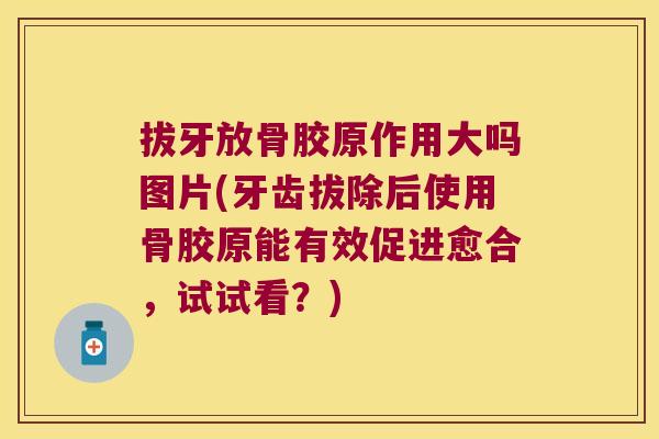 拔牙放骨胶原作用大吗图片(牙齿拔除后使用骨胶原能有效促进愈合,试试看?) 拔牙放骨胶原作用大吗图片(牙齿拔除后使用骨胶原能有效促进愈合,试试看?)