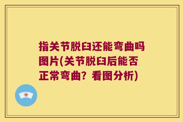 指关节脱臼还能弯曲吗图片(关节脱臼后能否正常弯曲?看图分析) 指关节脱臼还能弯曲吗图片(关节脱臼后能否正常弯曲?看图分析)