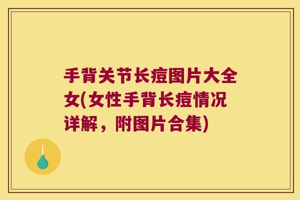手背关节长痘图片大全女(女性手背长痘情况详解,附图片合集) 手背关节长痘图片大全女(女性手背长痘情况详解,附图片合集)