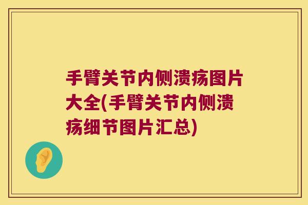手臂关节内侧溃疡图片大全(手臂关节内侧溃疡细节图片汇总) 手臂关节内侧溃疡图片大全(手臂关节内侧溃疡细节图片汇总)