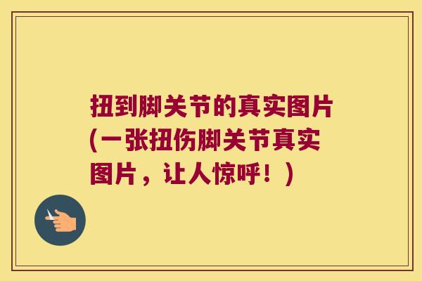 扭到脚关节的真实图片(一张扭伤脚关节真实图片,让人惊呼!) 扭到脚关节的真实图片(一张扭伤脚关节真实图片,让人惊呼!)
