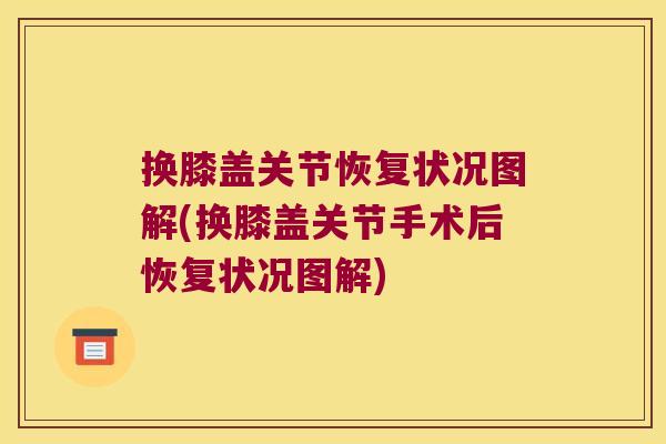 换膝盖关节恢复状况图解(换膝盖关节手术后恢复状况图解) 换膝盖关节恢复状况图解(换膝盖关节手术后恢复状况图解)