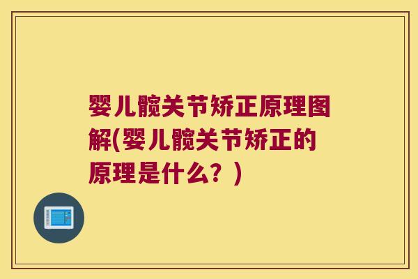 婴儿髋关节矫正原理图解(婴儿髋关节矫正的原理是什么？)