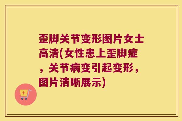 歪脚关节变形图片女士高清(女性患上歪脚症，关节变引起变形，图片清晰展示)