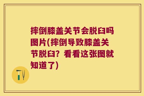 摔倒膝盖关节会脱臼吗图片(摔倒导致膝盖关节脱臼?看看这张图就知道了) 摔倒膝盖关节会脱臼吗图片(摔倒导致膝盖关节脱臼?看看这张图就知道了)