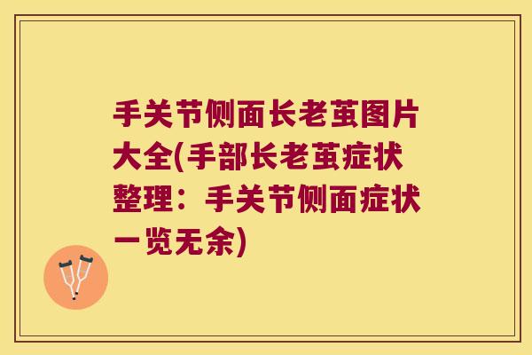 手关节侧面长老茧图片大全(手部长老茧症状整理:手关节侧面症状一览无余) 手关节侧面长老茧图片大全(手部长老茧症状整理:手关节侧面症状一览无余)