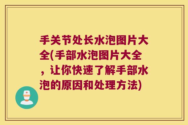 手关节处长水泡图片大全(手部水泡图片大全,让你快速了解手部水泡的原因和处理方法) 手关节处长水泡图片大全(手部水泡图片大全,让你快速了解手部水泡的原因和处理方法)