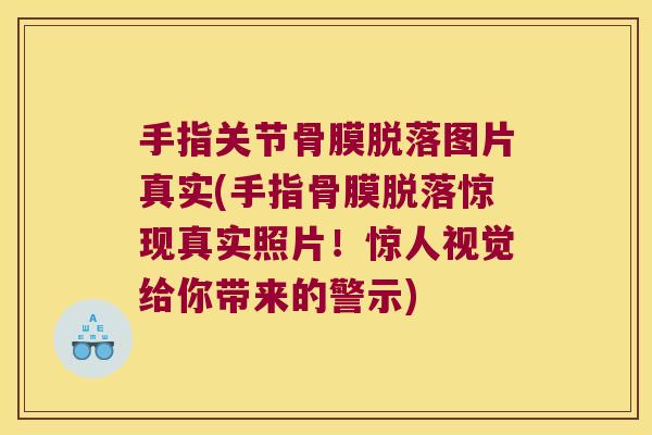 手指关节骨膜脱落图片真实(手指骨膜脱落惊现真实照片！惊人视觉给你带来的警示)