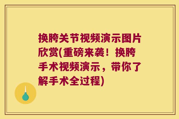 换胯关节视频演示图片欣赏(重磅来袭!换胯手术视频演示,带你了解手术全过程) 换胯关节视频演示图片欣赏(重磅来袭!换胯手术视频演示,带你了解手术全过程)
