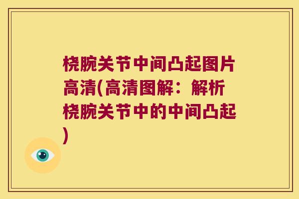 桡腕关节中间凸起图片高清(高清图解:解析桡腕关节中的中间凸起) 桡腕关节中间凸起图片高清(高清图解:解析桡腕关节中的中间凸起)