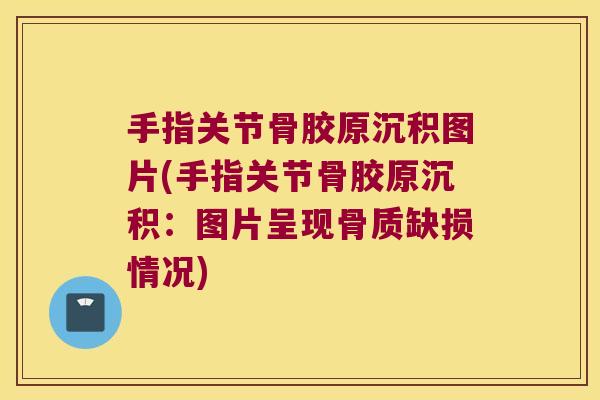 手指关节骨胶原沉积图片(手指关节骨胶原沉积:图片呈现骨质缺损情况) 手指关节骨胶原沉积图片(手指关节骨胶原沉积:图片呈现骨质缺损情况)