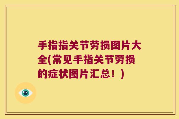 手指指关节劳损图片大全(常见手指关节劳损的症状图片汇总！)