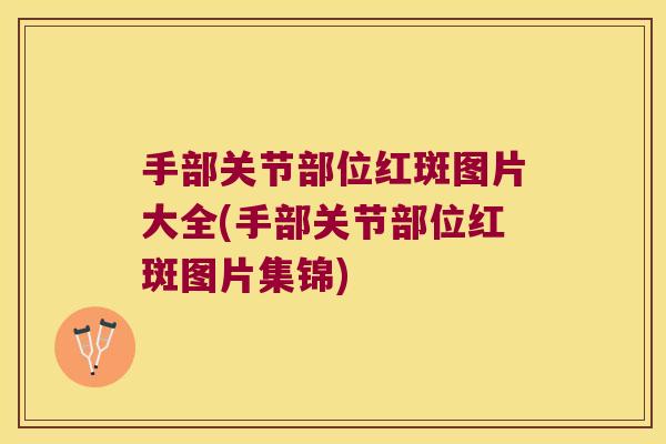 手部关节部位红斑图片大全(手部关节部位红斑图片集锦) 手部关节部位红斑图片大全(手部关节部位红斑图片集锦)