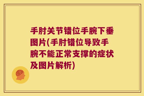 手肘关节错位手腕下垂图片(手肘错位导致手腕不能正常支撑的症状及图片解析) 手肘关节错位手腕下垂图片(手肘错位导致手腕不能正常支撑的症状及图片解析)