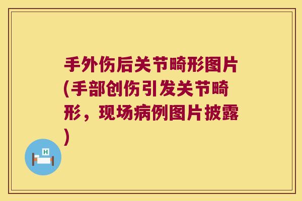 手外伤后关节畸形图片(手部创伤引发关节畸形，现场例图片披露)