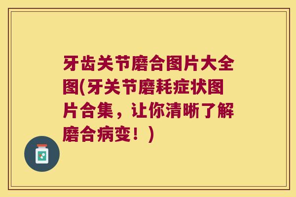 牙齿关节磨合图片大全图(牙关节磨耗症状图片合集,让你清晰了解磨合变!) 牙齿关节磨合图片大全图(牙关节磨耗症状图片合集,让你清晰了解磨合变!)