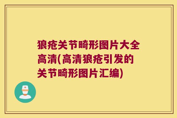 狼疮关节畸形图片大全高清(高清狼疮引发的关节畸形图片汇编)