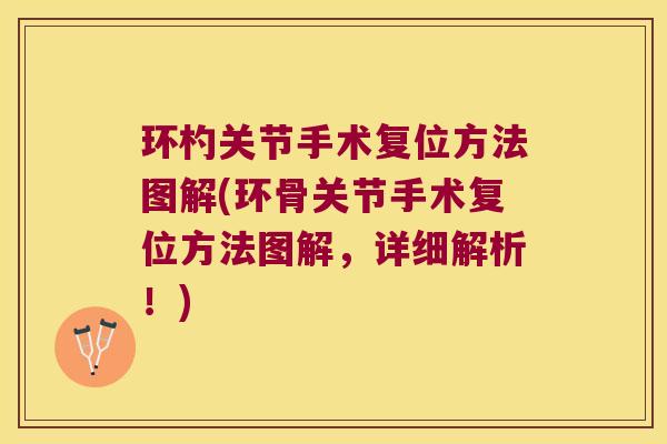 环杓关节手术复位方法图解(环骨关节手术复位方法图解,详细解析!) 环杓关节手术复位方法图解(环骨关节手术复位方法图解,详细解析!)