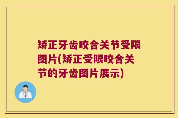 矫正牙齿咬合关节受限图片(矫正受限咬合关节的牙齿图片展示)
