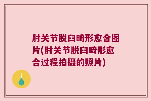肘关节脱臼畸形愈合图片(肘关节脱臼畸形愈合过程拍摄的照片)