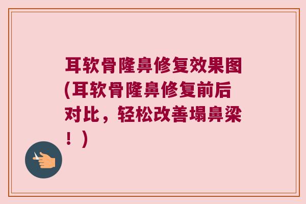 耳软骨隆鼻修复效果图(耳软骨隆鼻修复前后对比，轻松改善塌鼻梁！)