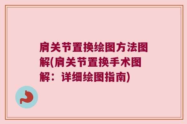 肩关节置换绘图方法图解(肩关节置换手术图解:详细绘图指南) 肩关节置换绘图方法图解(肩关节置换手术图解:详细绘图指南)