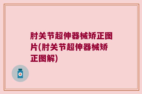肘关节超伸器械矫正图片(肘关节超伸器械矫正图解) 肘关节超伸器械矫正图片(肘关节超伸器械矫正图解)