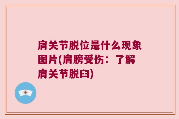 肩关节脱位是什么现象图片(肩膀受伤:了解肩关节脱臼) 肩关节脱位是什么现象图片(肩膀受伤:了解肩关节脱臼)
