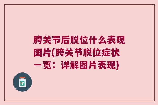 胯关节后脱位什么表现图片(胯关节脱位症状一览：详解图片表现)