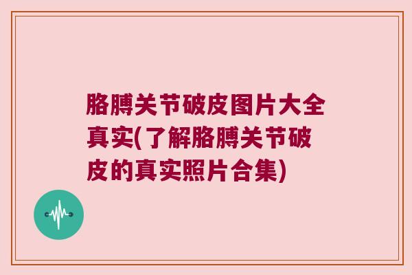 胳膊关节破皮图片大全真实(了解胳膊关节破皮的真实照片合集) 胳膊关节破皮图片大全真实(了解胳膊关节破皮的真实照片合集)