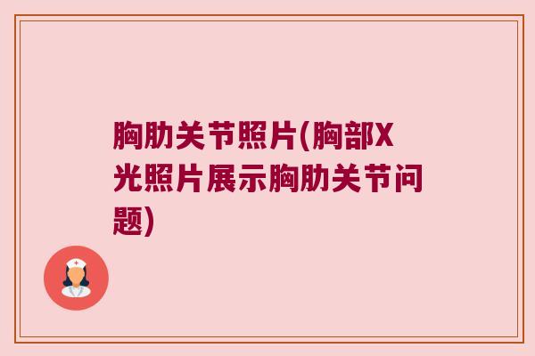 胸肋关节照片(胸部X光照片展示胸肋关节问题) 胸肋关节照片(胸部X光照片展示胸肋关节问题)